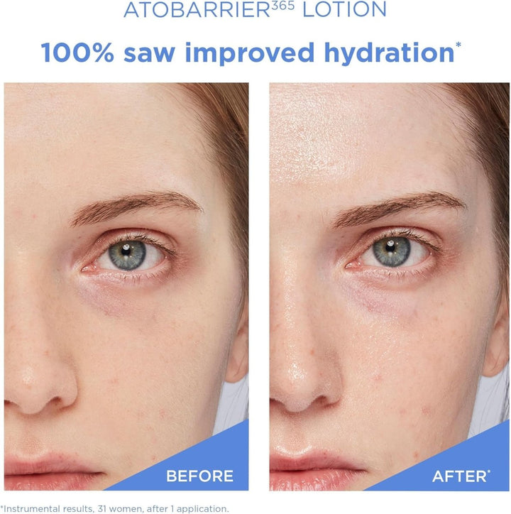 AESTURA Atobarrier 365 Lotion 150ml Moisturizer Kbeauty markham toronto free ship USA asian korean