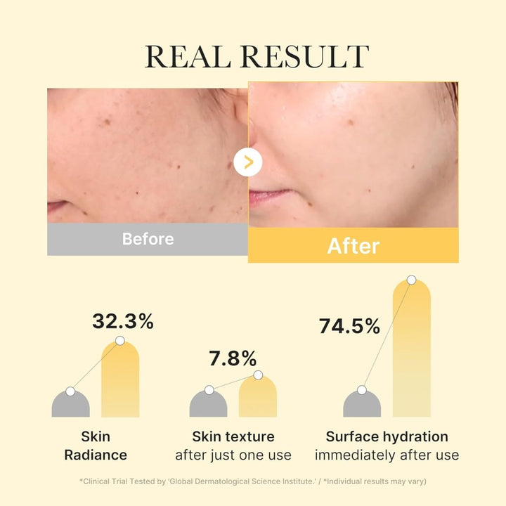 MEDICUBE Kojic Acid Turmeric Brightening Gel Mask 1Pcs Health & Beauty