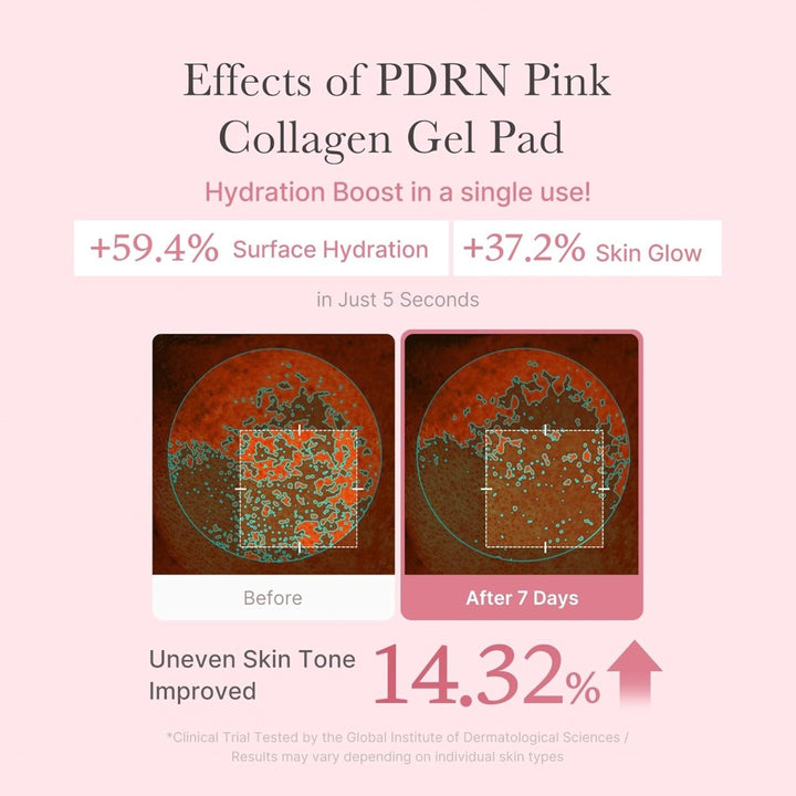 MEDICUBE PDRN Pink Collagen Toning Gel Toner Pad 70 Pads Health & Beauty