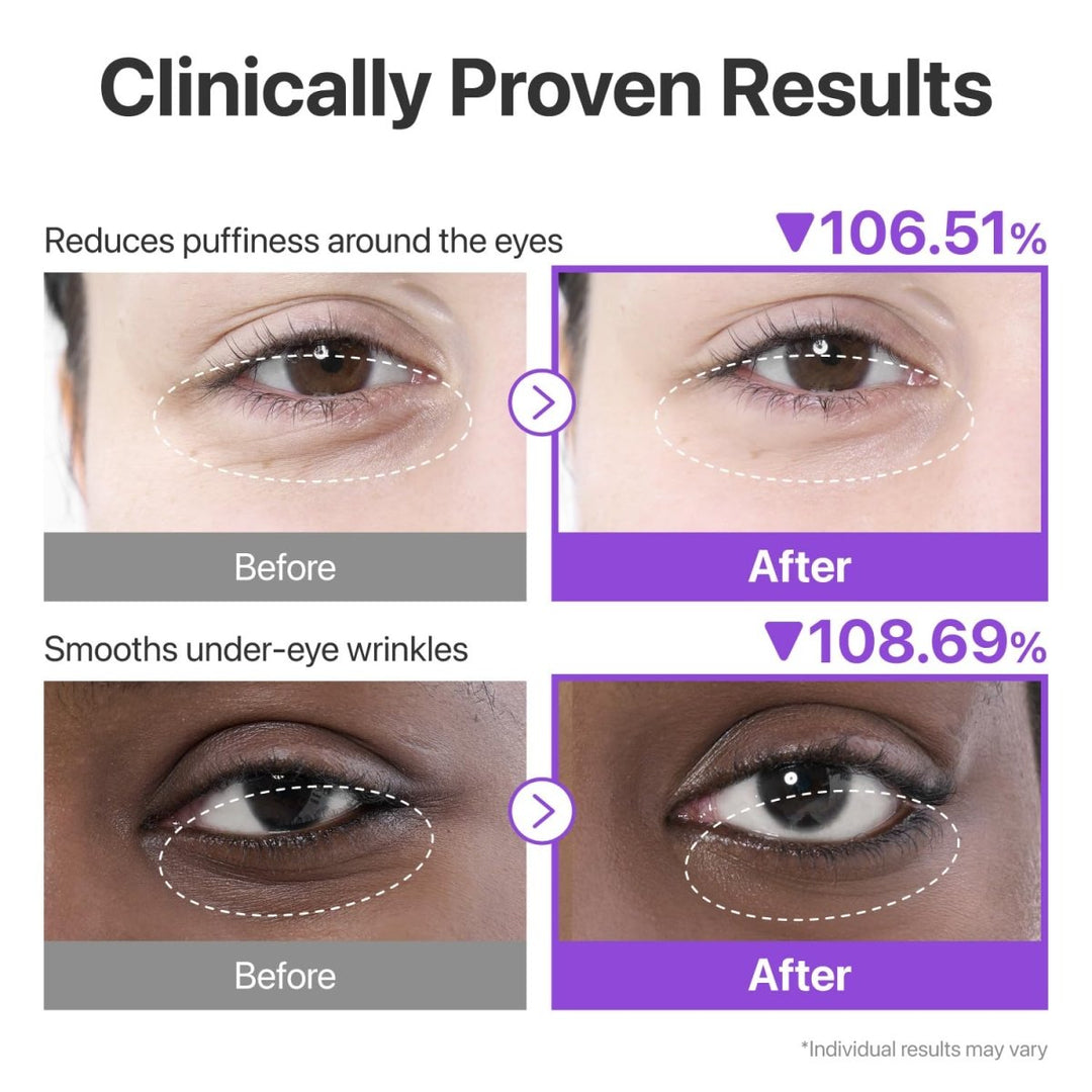 NUMBUZIN No.9 NAD+ Collagen Under Eye Patches 5 Pairs Health & Beauty 4